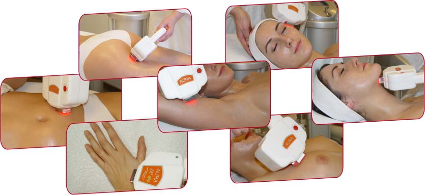 Thermolifting IR Aura