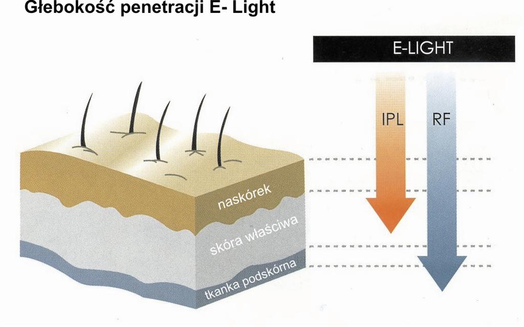Gboko penetracji E-Light